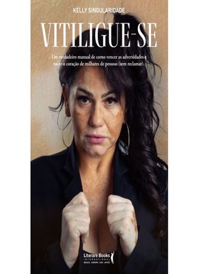 cover image of Vitiligue-se